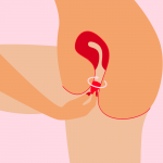 SP Insert How to Use